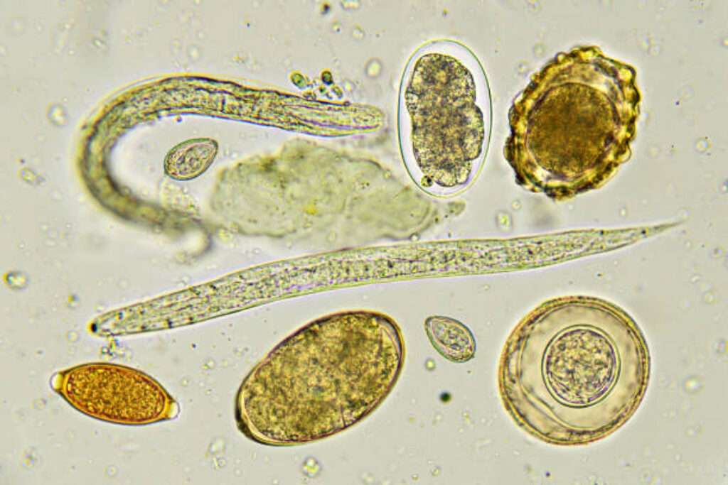 Risultati clinici Worlex in Italia contro elminti e parassiti.
Elminti nelle feci, analisi al microscopio